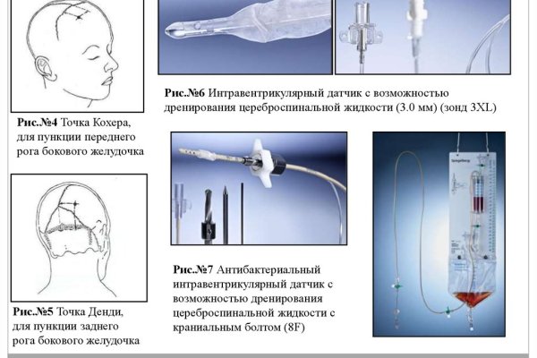 Как найти настоящую кракен даркнет ссылку